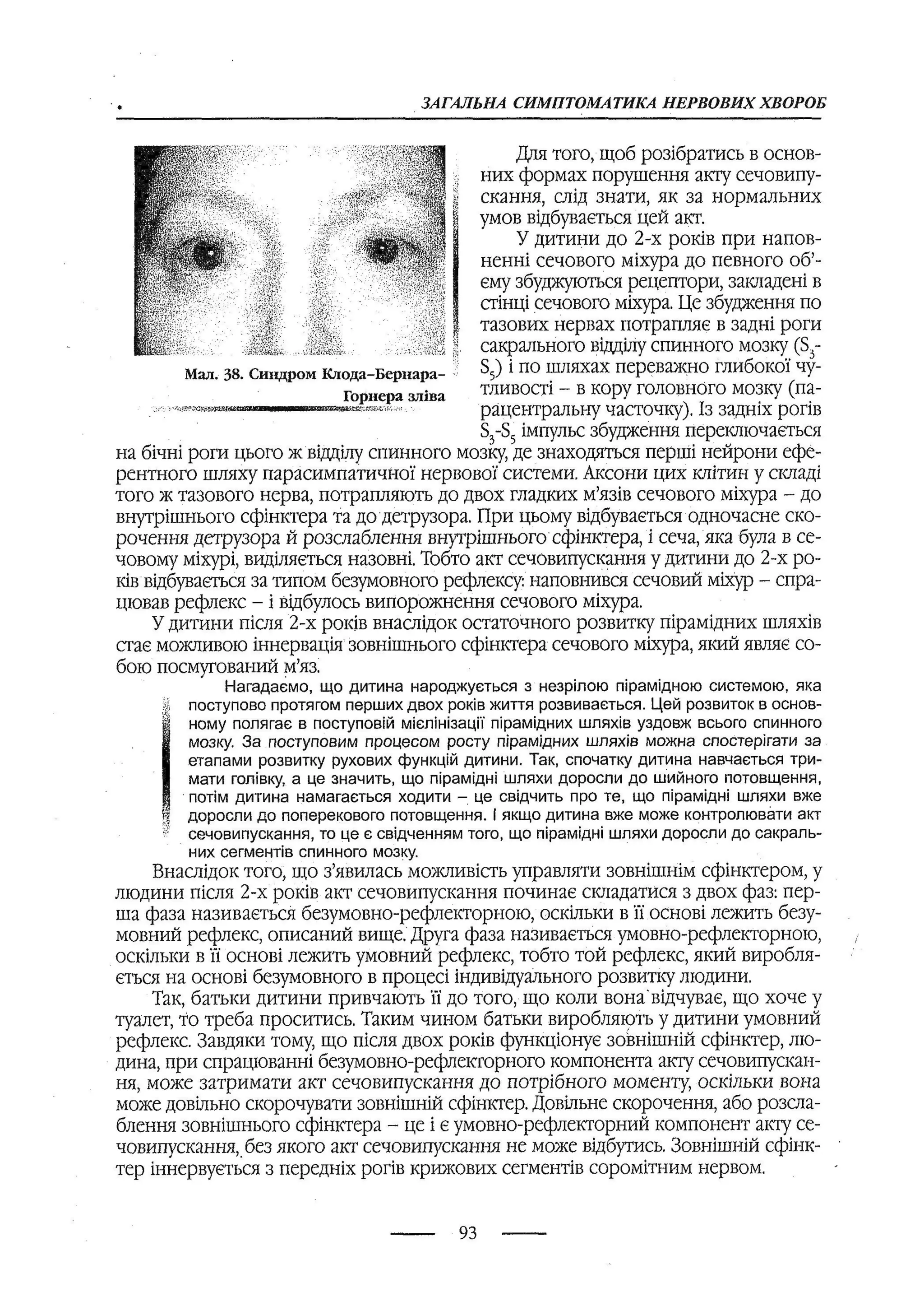 медсестринство в неврології за ред. В.М. Пашковський, І.І. Кричун, І.І. Кривецька, І.Я. ст.254 , 2003р