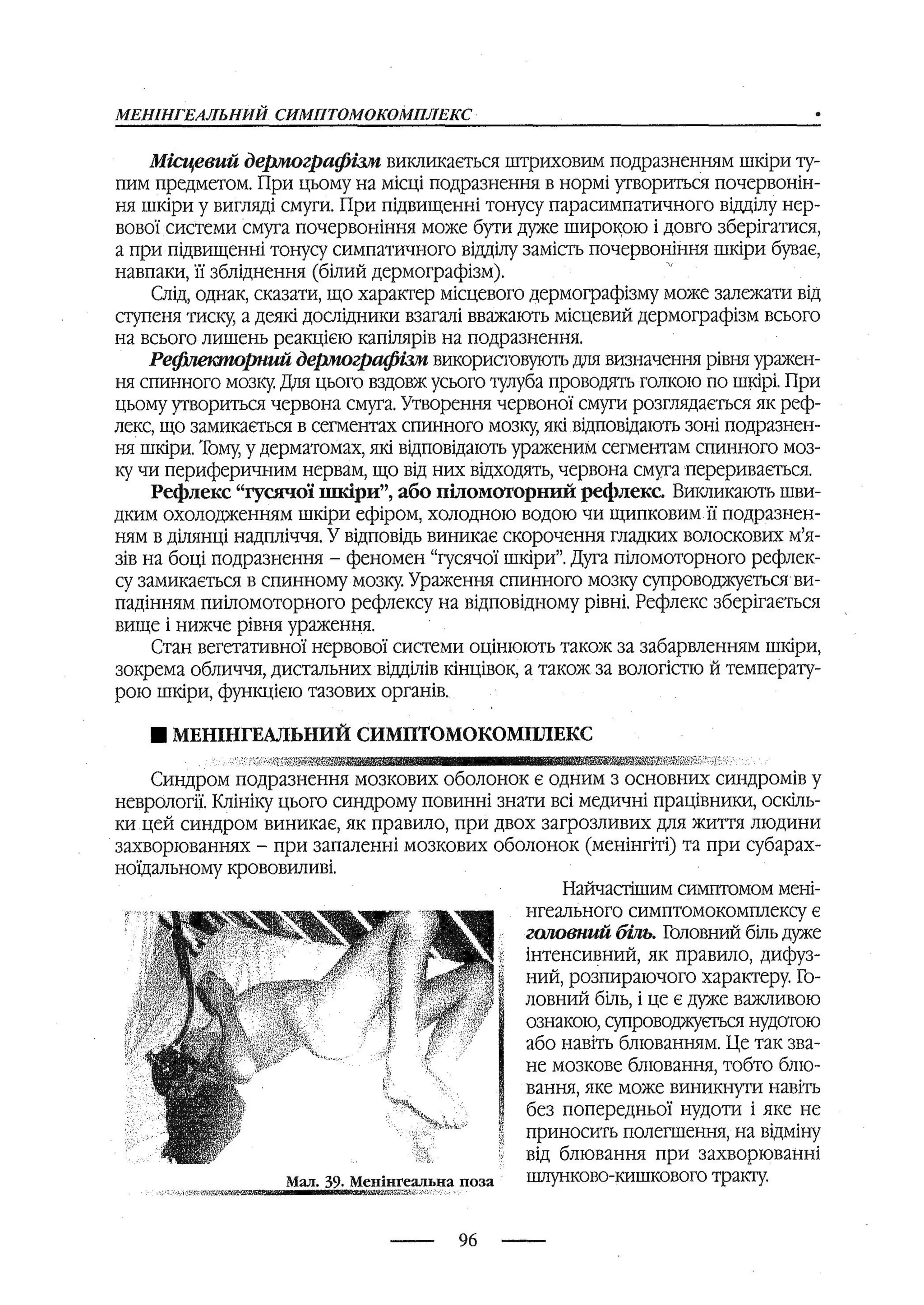 медсестринство в неврології за ред. В.М. Пашковський, І.І. Кричун, І.І. Кривецька, І.Я. ст.254 , 2003р