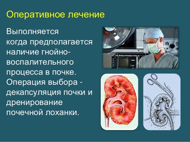 Как вылечить цистит медикаментами