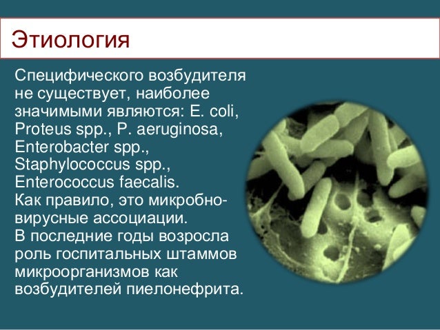Как вылечить глаз народными средствами