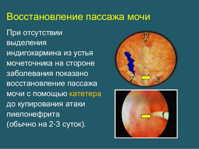 Коленно-локтевое положение при беременности в 2019 году Коленно-локтевое положение при беременности в 2019 году