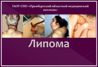ГАОУ СПО «Оренбургский областной медицинский
колледж»
 