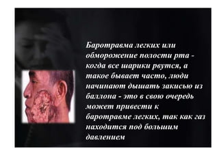 Баротравма легких или
обморожение полости рта -
когда все шарики рвутся, а
такое бывает часто, люди
начинают дышать закисью из
баллона - это в свою очередь
может привести к
баротравме легких, так как газ
находится под большим
давлением
 