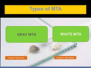 GRAY MTA WHITE MTA
 
