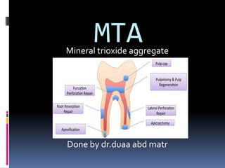 MTAMineral trioxide aggregate
Done by dr.duaa abd matr
 