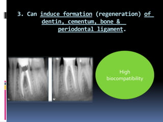 3. Can induce formation (regeneration) of
dentin, cementum, bone &
periodontal ligament.
High
biocompatibility
 