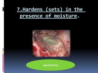 7.Hardens (sets) in the
presence of moisture.
apicoectomy
 