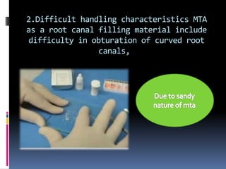2.Difficult handling characteristics MTA
as a root canal filling material include
difficulty in obturation of curved root
canals,
 