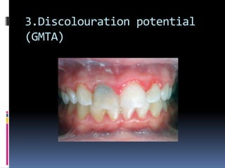 3.Discolouration potential
(GMTA)
 
