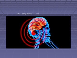 Так облучается мозг
 