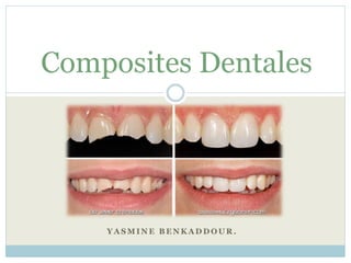 Y A S M I N E B E N K A D D O U R .
Composites Dentales
 