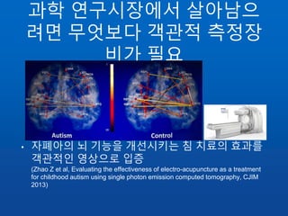 과학 연구시장에서 살아남으
려면 무엇보다 객관적 측정장
비가 필요
• 자폐아의 뇌 기능을 개선시키는 침 치료의 효과를
객관적인 영상으로 입증
(Zhao Z et al, Evaluating the effectiveness of electro-acupuncture as a treatment
for childhood autism using single photon emission computed tomography, CJIM
2013)
 