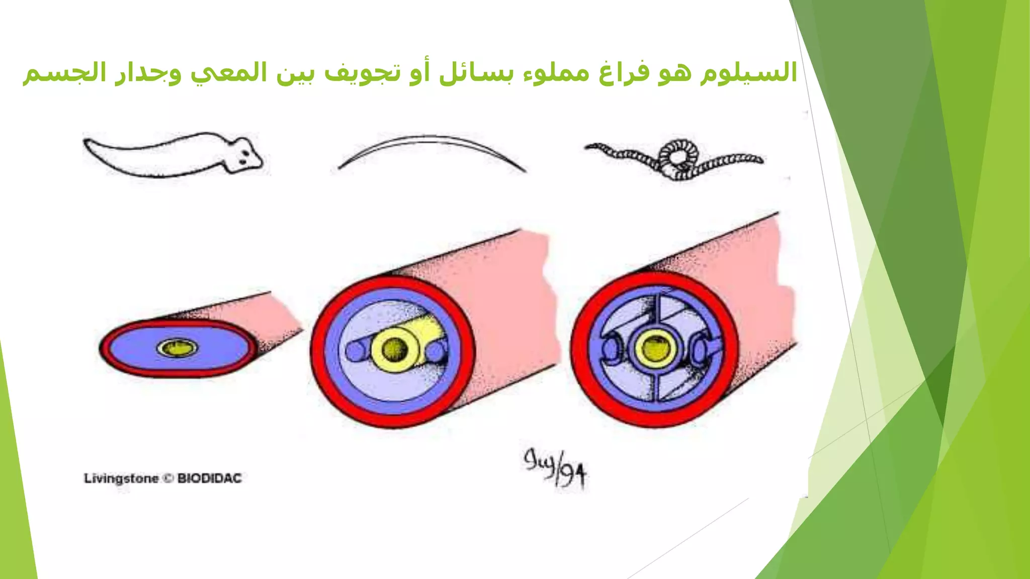 ‫السيلوم‬‫الج‬ ‫وجدار‬ ‫المعي‬ ‫بين‬ ‫تجويف‬ ‫أو‬ ‫بسائل‬ ‫مملوء‬ ‫فراغ‬ ‫هو‬‫سم‬
 