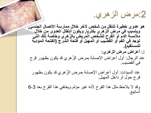 الأمراض المنقولة جنسيا