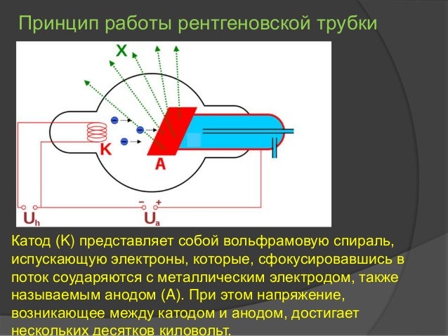 рентгеновские лучи