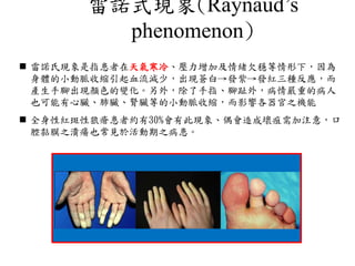 雷諾式現象(Raynaud’s
phenomenon)
 雷諾氏現象是指患者在天氣寒冷、壓力增加及情緒欠穩等情形下，因為
身體的小動脈收縮引起血流減少，出現蒼白→發紫→發紅三種反應，而
產生手腳出現顏色的變化。另外，除了手指、腳趾外，病情嚴重的病人
也可能有心臟、肺臟、腎臟等的小動脈收縮，而影響各器官之機能
 全身性紅斑性狼瘡患者約有30%會有此現象、偶會造成壞疽需加注意，口
腔黏膜之潰瘍也常見於活動期之病患。
待蔡醫師提供案例照片
 