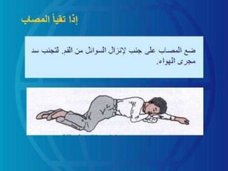 الاسعافات الاولية بالصور