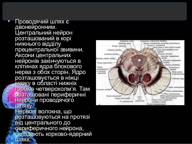 Моторная дизартрия это