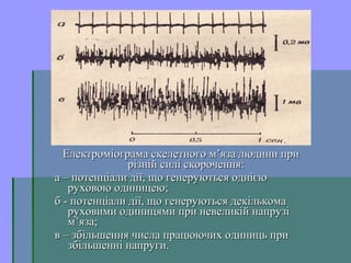 Електроміограма скелетного м’яза людини приЕлектроміограма скелетного м’яза людини при
різній силі скорочення:різній силі скорочення:
а – потенціали дії, що генеруються однієюа – потенціали дії, що генеруються однією
руховою одиницею;руховою одиницею;
б - потенціали дії, що генеруються декількомаб - потенціали дії, що генеруються декількома
руховими одиницями при невеликій напрузіруховими одиницями при невеликій напрузі
м’яза;м’яза;
в – збільшення числа працюючих одиниць прив – збільшення числа працюючих одиниць при
збільшенні напруги.збільшенні напруги.
 