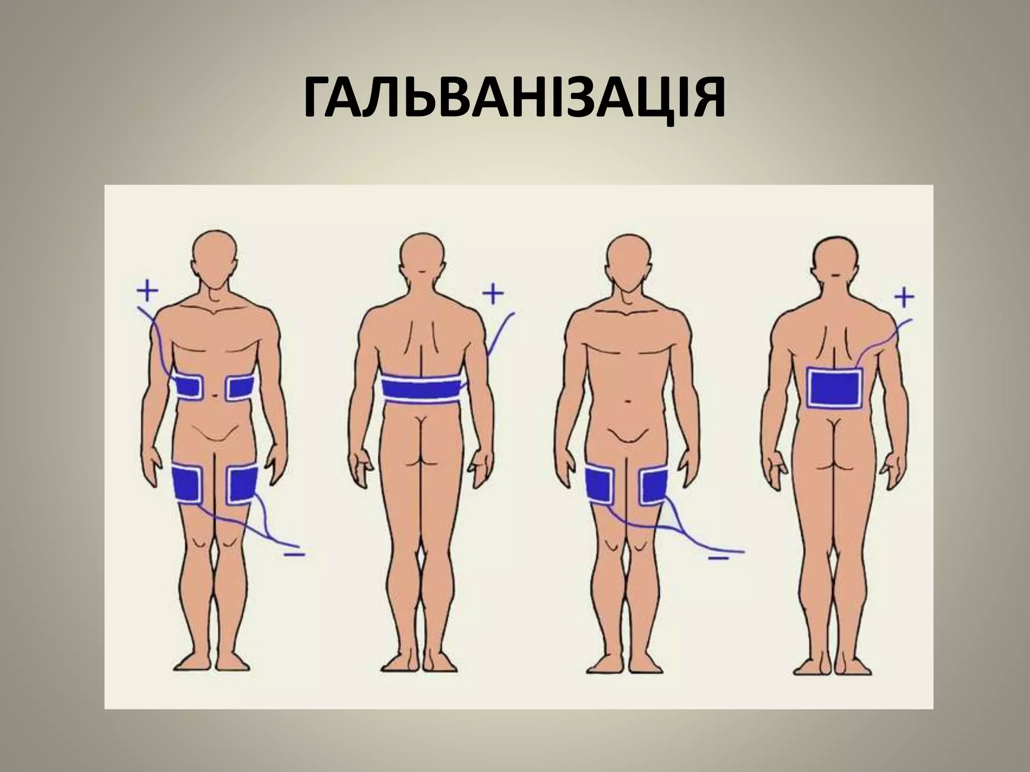 ГАЛЬВАНІЗАЦІЯ
 