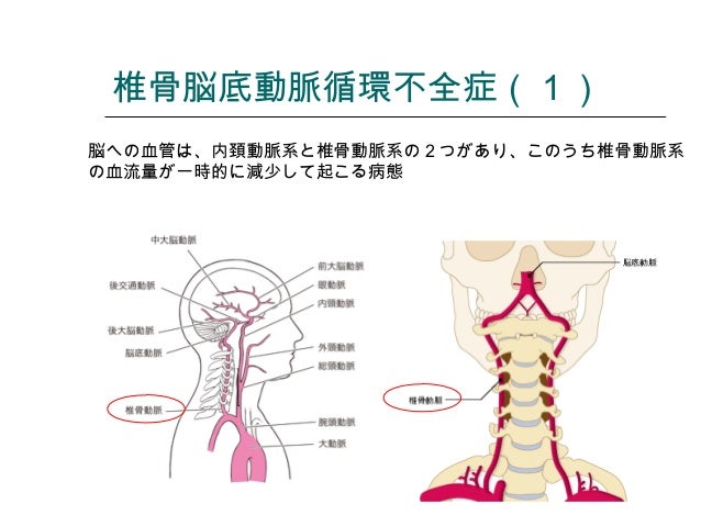めまい めまい