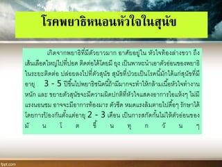 โรคพยาธิหนอนหัวใจในสุนัข
เกิดจากพยาธิที่มีตัวยาวมาก อาศัยอยู่ใน หัวใจท้องล่างขวา ถึง
เส้นเลือดใหญ่ไปที่ปอด ติดต่อได้โดยมี ยุง เป็นพาหะนาเอาตัวอ่อนของพยาธิ
ในระยะติดต่อ ปล่อยลงไปที่ตัวสุนัข สุนัขที่ป่วยเป็นโรคนี้มักได้แก่สุนัขที่มี
อายุ 3 - 5 ปีขึ้นไปพยาธิชนิดนี้ถ้ามีมากจะทาให้กล้ามเนื้อหัวใจทางาน
หนัก และ ขยายตัวสุนัขจะมีความผิดปกติที่หัวใจแสดงอาการไอแห้งๆ ไม่มี
แรงนอนซม อาจจะมีอาการท้องมาร ตัวซีด หมดแรงล้มตายไปดื้อๆ รักษาได้
โดยการป้ องกันตั้งแต่อายุ 2 - 3 เดือน เป็นการสกัดกั้นไม่ให้ตัวอ่อนของ
มั น โ ต ขึ้ น ทุ ก วั น ๆ
 