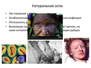 Натуральная оспа
• Лат название variola
• Особоопасная воздушно-капельная вирусная инфекция
• Летальность до 90%
• Выжившие полностью или частично теряют зрение, на
коже остаются множество обезображивающих рубцов
 