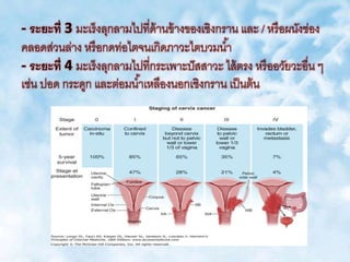 - ระยะที่ 3 มะเร็งลุกลามไปที่ด้านข้างของเชิงกราน และ / หรือผนังช่อง
คลอดส่วนล่าง หรือกดท่อไตจนเกิดภาวะไตบวมน้า
- ระยะที่ 4 มะเร็งลุกลามไปที่กระเพาะปัสสาวะ ไส้ตรง หรืออวัยวะอื่น ๆ
เช่น ปอด กระดูก และต่อมน้าเหลืองนอกเชิงกราน เป็นต้น
 