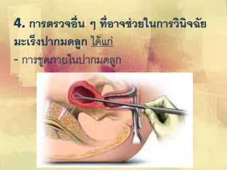 4. การตรวจอื่น ๆ ที่อาจช่วยในการวินิจฉัย
มะเร็งปากมดลูก ได้แก่
- การขูดภายในปากมดลูก
 