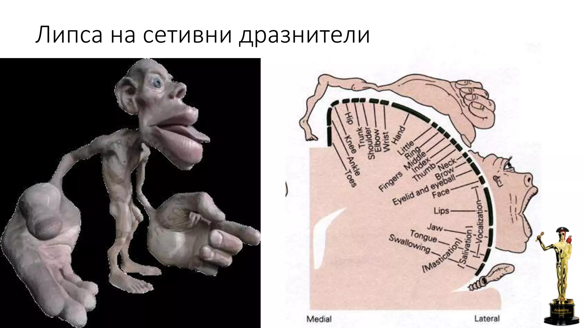 Липса на сетивни дразнители
 