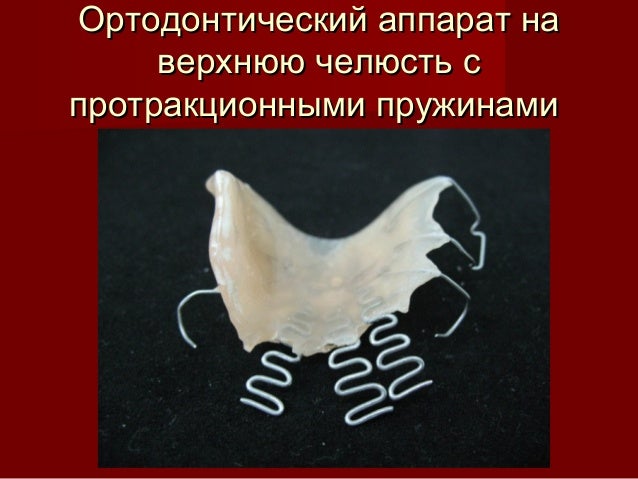 ортодонтия