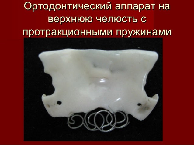 ортодонтия