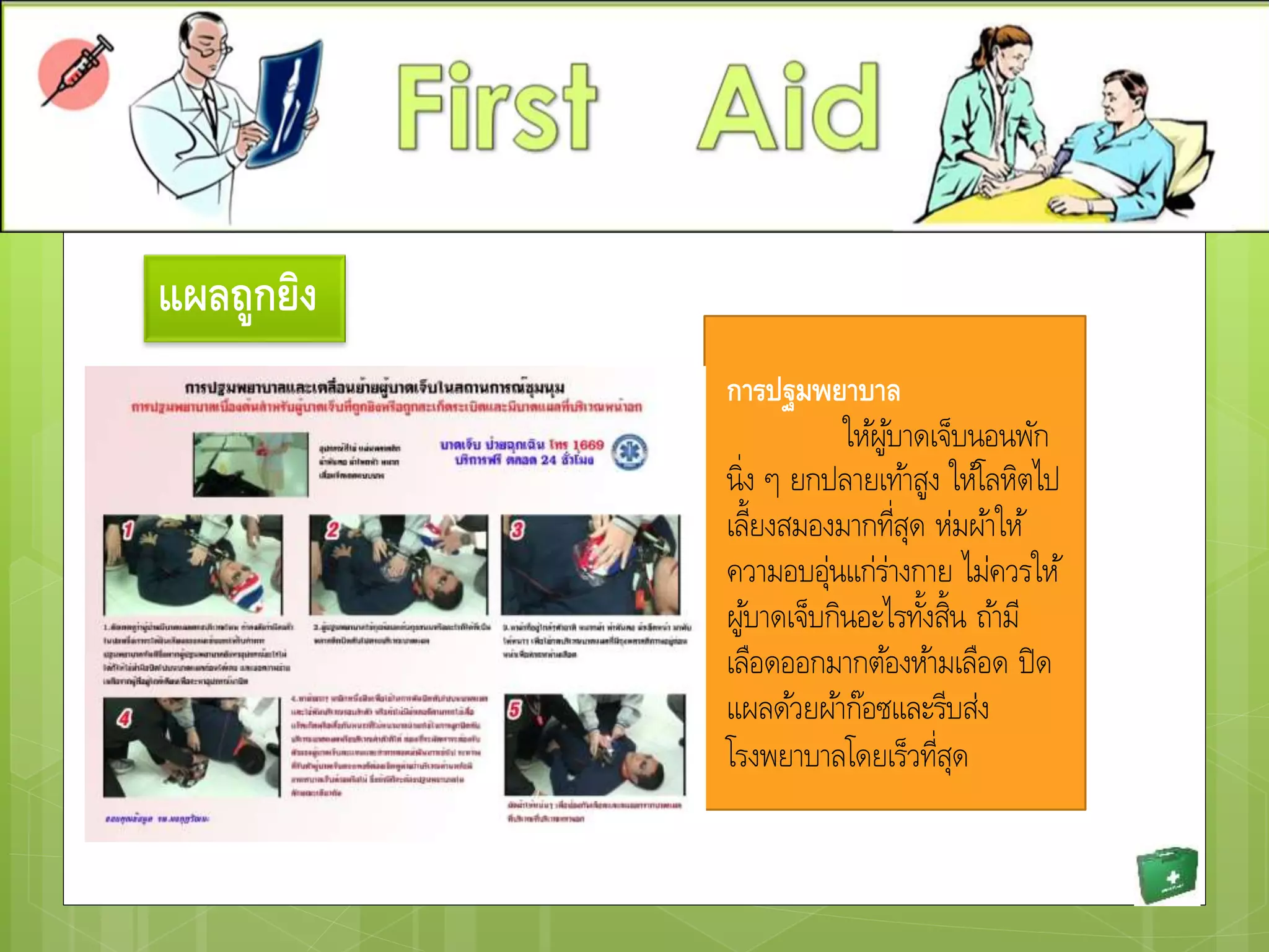 แผลถูกยิง
การปฐมพยาบาล
ให้ผู้บาดเจ็บนอนพัก
นิ่ง ๆ ยกปลายเท้าสูง ให้โลหิตไป
เลี้ยงสมองมากที่สุด ห่มผ้าให้
ความอบอุ่นแก่ร่างกาย ไม่ควรให้
ผู้บาดเจ็บกินอะไรทั้งสิ้น ถ้ามี
เลือดออกมากต้องห้ามเลือด ปิด
แผลด้วยผ้าก๊อซและรีบส่ง
โรงพยาบาลโดยเร็วที่สุด
 