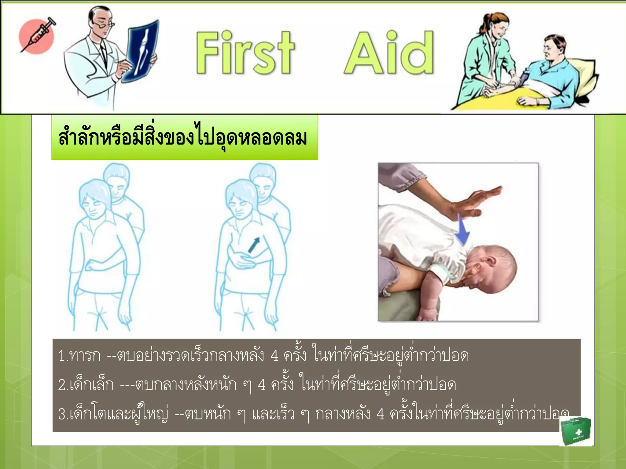 สาลักหรือมีสิ่งของไปอุดหลอดลม
1.ทารก --ตบอย่างรวดเร็วกลางหลัง 4 ครั้ง ในท่าที่ศรีษะอยู่ต่ากว่าปอด
2.เด็กเล็ก ---ตบกลางหลังหนัก ๆ 4 ครั้ง ในท่าที่ศรีษะอยู่ต่ากว่าปอด
3.เด็กโตและผู้ใหญ่ --ตบหนัก ๆ และเร็ว ๆ กลางหลัง 4 ครั้งในท่าที่ศรีษะอยู่ต่ากว่าปอด
 
