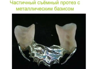 съёмные протезы