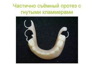 съёмные протезы