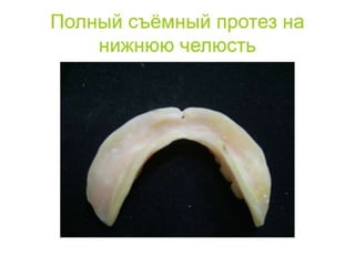 съёмные протезы