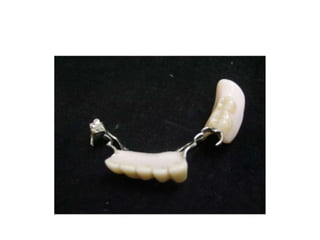 съёмные протезы