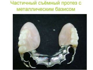 съёмные протезы