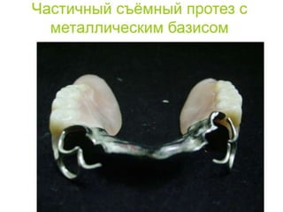 съёмные протезы