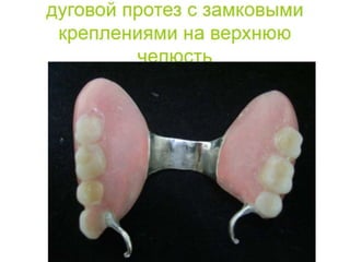 съёмные протезы
