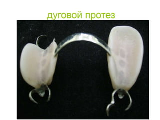 съёмные протезы