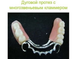 съёмные протезы