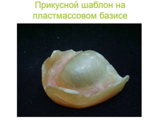 съёмные протезы