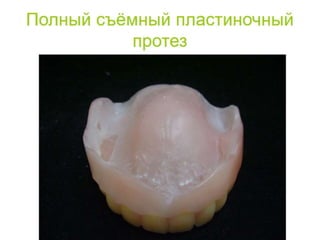 съёмные протезы