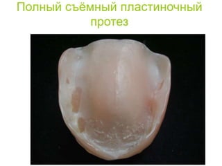 съёмные протезы