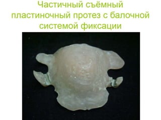 съёмные протезы