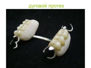 съёмные протезы
