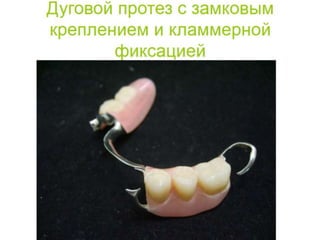 съёмные протезы