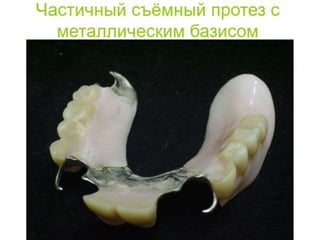 съёмные протезы